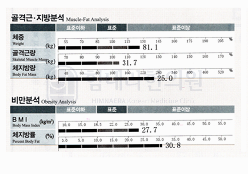치료 전 이미지