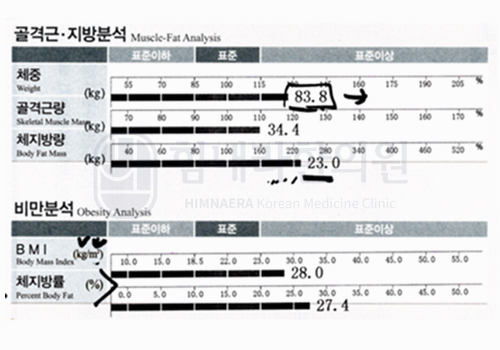 치료 후 이미지