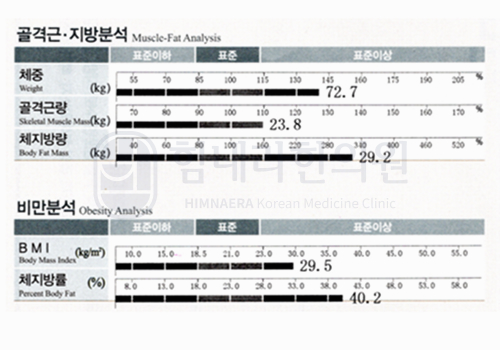 치료 전 이미지